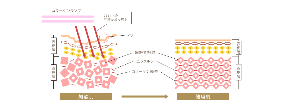 コラーゲンマシーンによる肌状態の変化